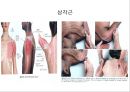 오십견 재활 운동 (Adhesive capsulitis, 1단계 통증 경감 시기, 2단계 적극적 가동범위 회복, 3단계 견갑대 강화 시기).PPT자료 26페이지
