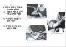 오십견 재활 운동 (Adhesive capsulitis, 1단계 통증 경감 시기, 2단계 적극적 가동범위 회복, 3단계 견갑대 강화 시기).PPT자료 36페이지