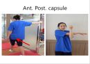 오십견 재활 운동 (Adhesive capsulitis, 1단계 통증 경감 시기, 2단계 적극적 가동범위 회복, 3단계 견갑대 강화 시기).PPT자료 57페이지