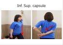오십견 재활 운동 (Adhesive capsulitis, 1단계 통증 경감 시기, 2단계 적극적 가동범위 회복, 3단계 견갑대 강화 시기).PPT자료 58페이지