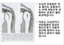 오십견 재활 운동 (Adhesive capsulitis, 1단계 통증 경감 시기, 2단계 적극적 가동범위 회복, 3단계 견갑대 강화 시기).PPT자료 82페이지