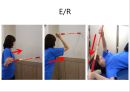 회선근개 재활 운동 (어깨 수술의 이해 Shoulder operation, 어깨 재활 운동 0~2주 재활운동, ROM Exercise, 스트레칭 Stretching, Simple EX 10분).PPT자료 34페이지