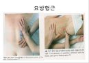 요추 염좌의 재활 운동 7페이지