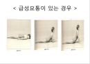 요추 염좌의 재활 운동 17페이지