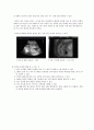 [사범/법학] [태내기] 태내 환경, 태내기 진단(유전상담, 초음파, 융모, 양수검사등), 태내기 교육(전통, 현대적), 태내기에 대한 견해 10페이지