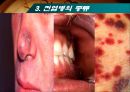 질병의 글로벌리제이션과 글로벌 대응 (전염병의 글로벌리제이션, 전염병의 전이, 전염병의 종류와 현황, 전염병에 대한 글로벌 대응).PPT자료 19페이지