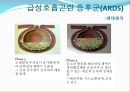 ARDS(급성호흡곤란 증후군)의 환자간호 (History, 진단적 기준, 발병률, 사망률, 원인, 병태생리, 기계적 치료, 내과적 치료).PPT자료 10페이지