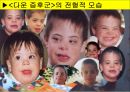 [특수교육] 정신지체의 생물학적 원인, 정신지체의 다양한 원인, 질병등 15페이지