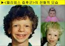 [특수교육] 정신지체의 생물학적 원인, 정신지체의 다양한 원인, 질병등 20페이지