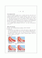 동맥경화증에 대한 케이스 case : 진단명 : ASO, both(arteriosclerosis obliterans, 폐색성 동맥경화증) 2페이지