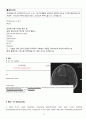 뇌종양 (교모세포종, Glioblastoma) 17페이지