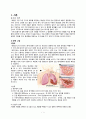 [아동간호학 Case] 폐렴(Pneumonia), 아동 케이스 case study (임상간호사례연구) 3페이지