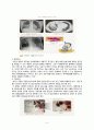 [아동간호학 Case] 폐렴(Pneumonia), 아동 케이스 case study (임상간호사례연구) 7페이지