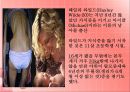 섭식장애의 개념과 원인 및 섭식장애 치료방안 10페이지