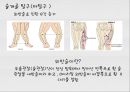 대퇴사두각(q angle)의 증가로 인한 부상의 종류 9페이지