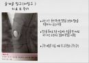 대퇴사두각(q angle)의 증가로 인한 부상의 종류 11페이지