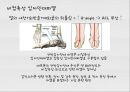 대퇴사두각(q angle)의 증가로 인한 부상의 종류 12페이지