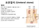 비뇨기계 질환과 간호 (신장 결석, 요관결석, 요로감염, 신장암, 방광염, 방광암, 과민성 방광, 요실금, 방광 결석, 방광요관역류, 전립선 비대증, 전립선염, 전립선 암, 음낭 질환, 고환암, 요도 협착).pptx 17페이지