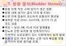 비뇨기계 질환과 간호 (신장 결석, 요관결석, 요로감염, 신장암, 방광염, 방광암, 과민성 방광, 요실금, 방광 결석, 방광요관역류, 전립선 비대증, 전립선염, 전립선 암, 음낭 질환, 고환암, 요도 협착).pptx 61페이지