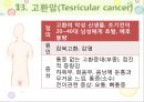 비뇨기계 질환과 간호 (신장 결석, 요관결석, 요로감염, 신장암, 방광염, 방광암, 과민성 방광, 요실금, 방광 결석, 방광요관역류, 전립선 비대증, 전립선염, 전립선 암, 음낭 질환, 고환암, 요도 협착).pptx 86페이지
