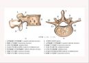 (스포츠의학, 운동처방관련학과) Spondylolisthesis 척추전방전위증 -정의 원인 증상 및 운동방법 4페이지