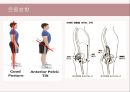 (스포츠의학, 운동처방관련학과) Spondylolisthesis 척추전방전위증 -정의 원인 증상 및 운동방법 17페이지