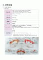 경막하출혈 case study 2페이지