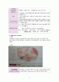 (중환자간호) 두개내압 상승간호 (두개내압 , 두개내압 감시, 뇌실 외 배액, 두개내압 상승 환자간호) 4페이지