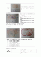 심전도(Electrocardiogram) EKG(중환자간호) 정의, 원리, 심전도 기록, 심전도 리듬의 분석, 심전도 판독  3페이지