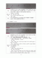심전도(Electrocardiogram) EKG(중환자간호) 정의, 원리, 심전도 기록, 심전도 리듬의 분석, 심전도 판독  10페이지