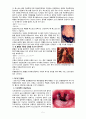 간호학)) 법정전염병 5페이지