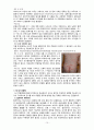 간호학)) 법정전염병 10페이지