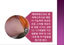 영유아의 건강관리(건강진단, 전염성 질환의 예방 및 관리) PPT자료, 파워포인트 43페이지
