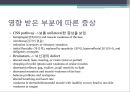 Stroke,뇌졸중 레포트_뇌졸중의 분류및 증상 4페이지
