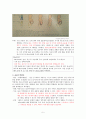 [혈액학적 장애들]빈혈(철분 결핍성빈혈 엽산 결핍성 빈혈) 5페이지