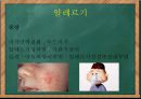 학령기 아동 영양-영양섭취기준,아동비만,아동정서발달,아동질환및질병사례 45페이지