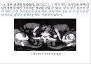 [수술실 케이스 컨퍼런스 (Case Conference)] 갑상선암 / 갑상선절제술.pptx 16페이지