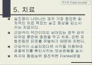 척수로(Tabes dorsalis) & 척수공동증(Syringomyelia)  13페이지
