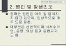 척수로(Tabes dorsalis) & 척수공동증(Syringomyelia)  16페이지