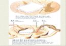 척수로(Tabes dorsalis) & 척수공동증(Syringomyelia)  18페이지