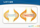 노년기 건강관리 및 운동 (노년기 건강의 중요성, 노년기 질병, 노년기의 운동, 걷기의 중요성).pptx 19페이지