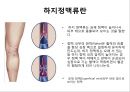 [스포츠의학관련] 의자 스트레칭 , 하지정맥류 19페이지