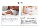 [스포츠의학관련] 의자 스트레칭 , 하지정맥류 21페이지