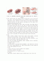 간호학 케이스 스터디 -난소종양(ovarian tumors) 5페이지