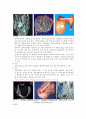 간호학 케이스 스터디 -난소종양(ovarian tumors) 9페이지