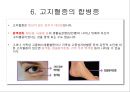 [스포츠의학, 운동처방관련학과] 고지혈증 정의, 원인, 합병증 및 운동처방, 콜레스테롤, 동맥경화.pptx 29페이지