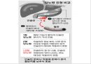 [스포츠의학, 운동처방관련학과] 당뇨병 (당뇨병 정의, 원인, 분류, 증상, 치료, 운동방법 등).pptx 29페이지