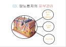 [스포츠의학, 운동처방관련학과] 당뇨병 (당뇨병 정의, 원인, 분류, 증상, 치료, 운동방법 등).pptx 34페이지