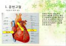 간호학과 심근경색 (Myocardial Infarction : MI) 케이스 스터디 case study.ppt 4페이지