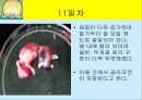 닭의 배 발생 과정.ppt 11페이지